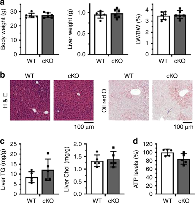 Hepatic HuR modulates lipid homeostasis in response to high-fat diet