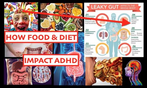 ADHD Food and Nutrition
