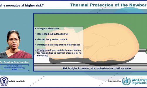 Thermal protection of the Newborn