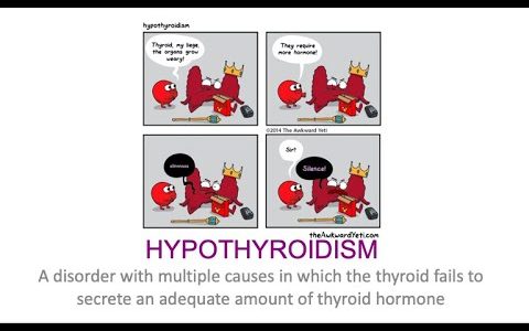 Disorders of the Thyroid Gland Part 2: Hypothyroidism and autoimmune thyroiditis
