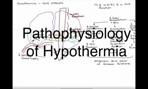 Hypothermia Pathophysiology