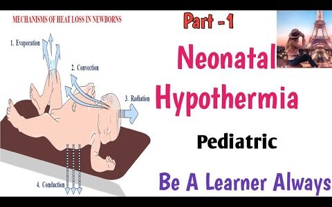 Neonatal Hypothermia