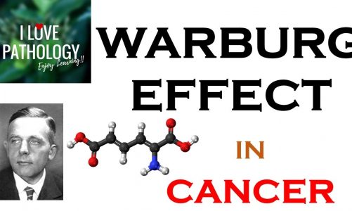 NEOPLASIA 6: WARBURG EFFECT: Hallmark of  CANCER. What, Why & How?
