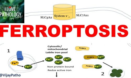 FERROPTOSIS : Iron dependent Programmed cell death. Mechanism , Applications.