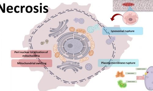 Necrosis : cellular mechanism and types