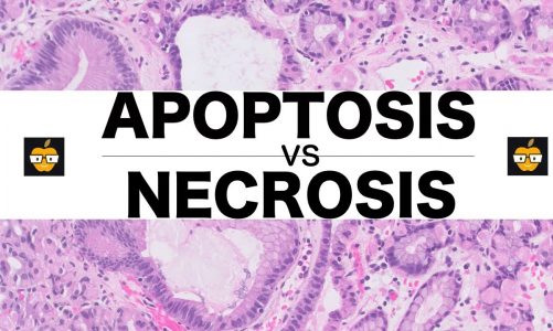 Apoptosis (Intrinsic, Extrinsic Pathways) vs. Necrosis