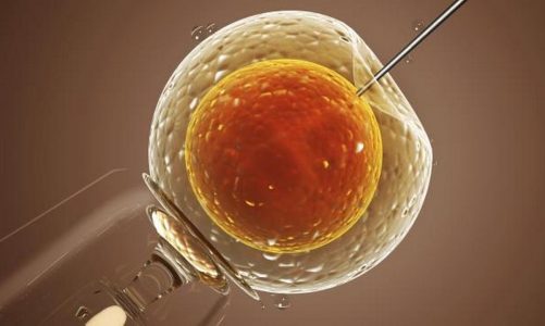 In vitro fertilization technique: it is to replace the defective mitochondria of the mother.