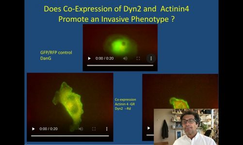 Keynote Presentation: Membrane-Cytoskeletal Dynamics in Disease