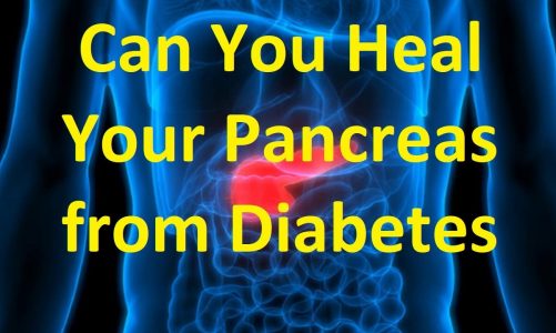 Can You Heal Your Pancreas from Diabetes (Type 1)