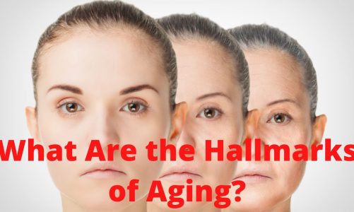 What Are the Hallmarks of Aging