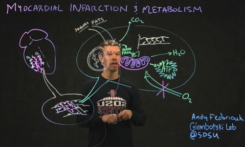 Myocardial Infarction & Metabolism, by Andy Fedoriouk