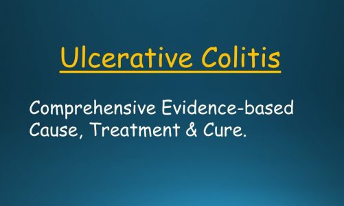 Ulcerative Colitis: Comprehensive Evidence-Based Explanation of the Cause, Treatment and Cure.