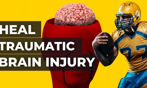 Why Athletes Develop Brain Damage & What To Do About It