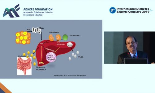 Dr.Vijay Negalur – Pathophysiology of Fatty Liver & T2D 1 | IDEC 2019