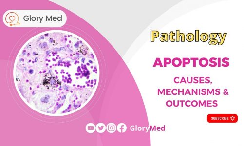 Pathology || Apoptosis: extrinsic, intrinsic & common pathways, caspases, causes…  made easy