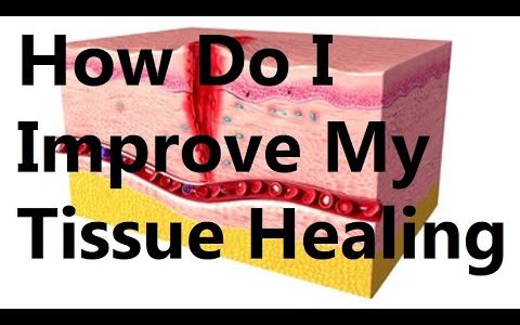 How Do I Improve My Tissue Healing?