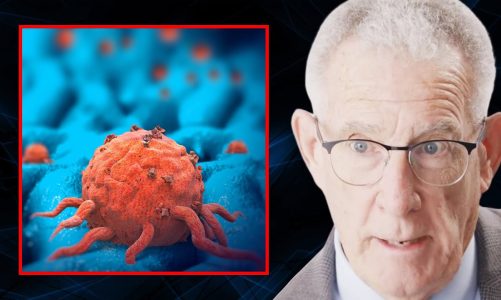 Take Control of THIS Huge Risk Factor for Cancer | Dr. Thomas Seyfried