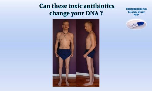 FIBROMYALGIA CHRONIC FATIGUE LEVAQUIN AVELOX CIPRO MITOCHONDRIAL DNA DAMAGE  ANTIBIOTIC SIDE EFFECTS