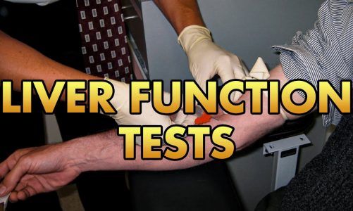 Liver Function Test Interpretation | LFTs Made Easy